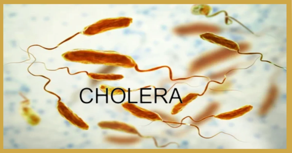 Cholera: Causes, Symptoms, Treatment, And Prevention - Your Ultimate ...